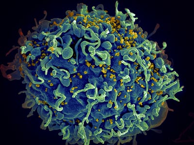 A microscopic image of a T-cell under attack by the HIV virus.