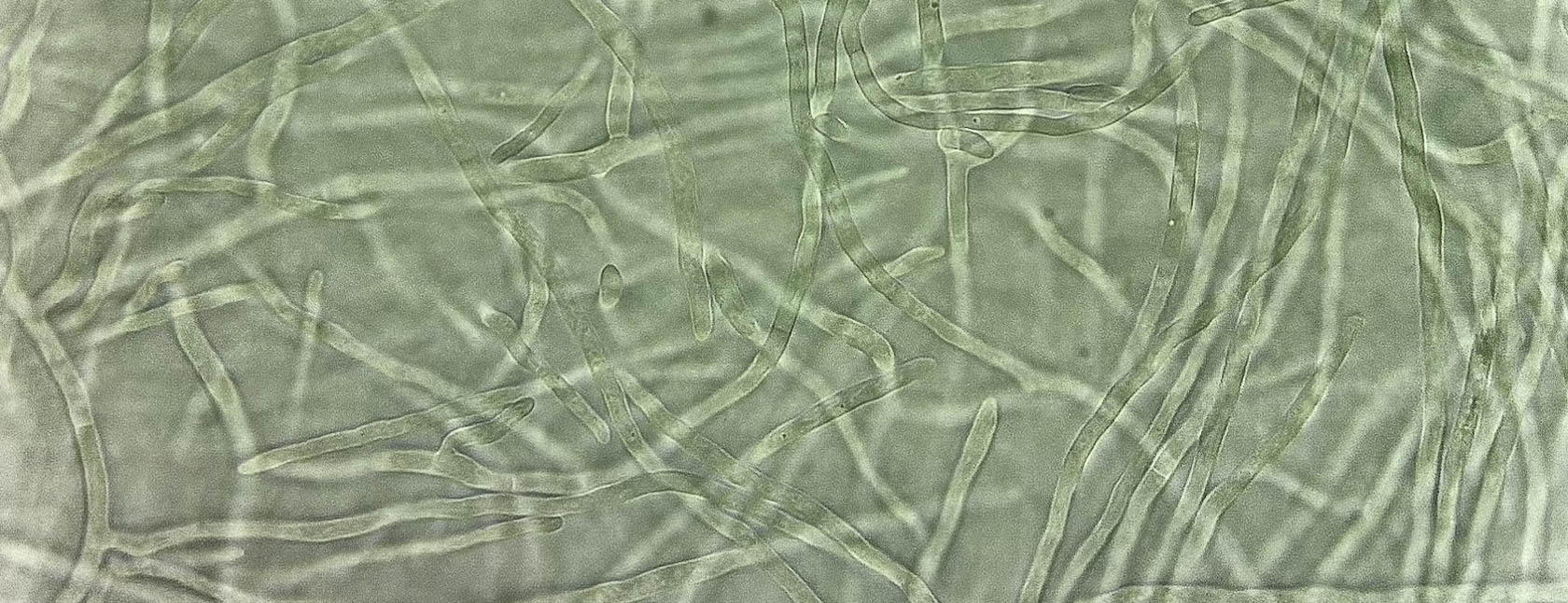 Fungal cells viewed under a microscope at 100x magnification